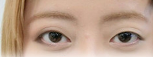 201604_Bobo Eyes