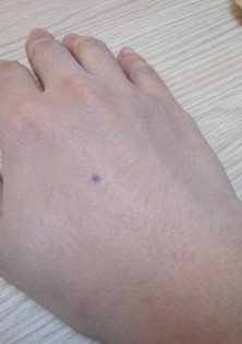 Hand